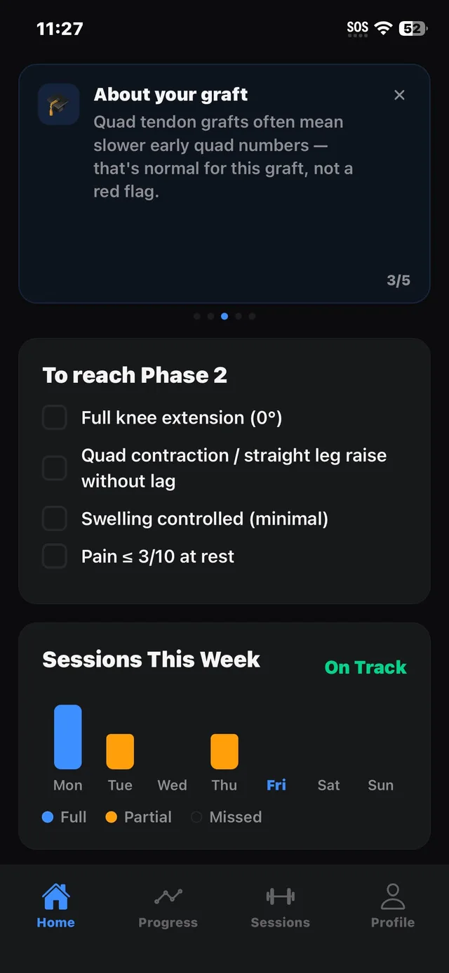 ACL Ready home screen during Phase 1, showing the criteria to reach Phase 2